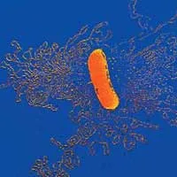 In this picture, magnified 15,000 times, can be seen the DNA molecule of a bacterium which has been exposed to special intervention. There are 4 million base pa