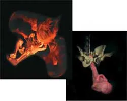 This picture shows the emergence of a baby through the mother's pelvis. The harmony in this design clearly shows the infinite wisdom and might in the creation o