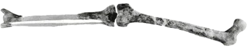 Femur KNM-ER 1472. This femur is no different from that of modern man. The finding of this fossil in the same layer as Homo habilis fossils, although a few kilo