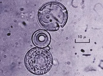 Fox's "Proteinoids" Sydney Fox, who was influenced by Miller's scenario, formed the above molecules, which he called "proteinoids," by joining amino acids toget