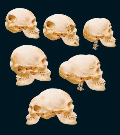 hayali kafataları, evrim, ara form