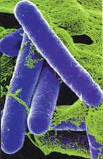 “You never say ‘impossible’ when you’re talking about life, because there are always some bacteria out there that will prove you wrong. But it’s highly unlikely