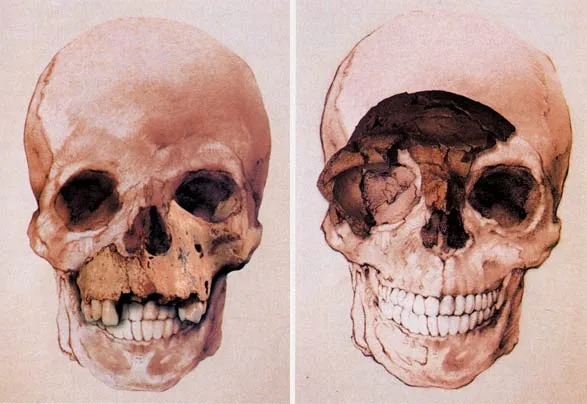 The reconstructed skull based on a fossil found in Atapuerca (left) bears an extraordinary resemblance to the skull of modern man (right).