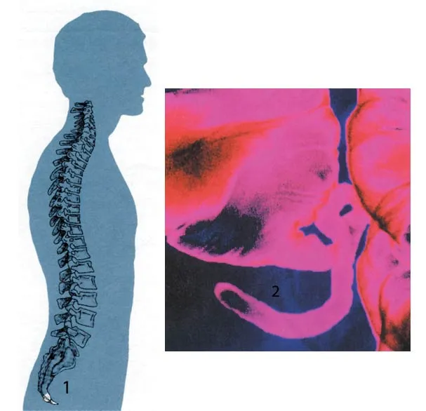 1.Coccyx, 2.Appendix It has now been realized that the appendix (below), which evolutionist biologists imagined to be vestigial, plays an important role in the