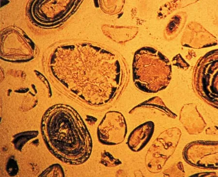 These 1.9-million-year-old fossilized bacteria, discovered in western Ontario, have the same structure as bacteria living today.