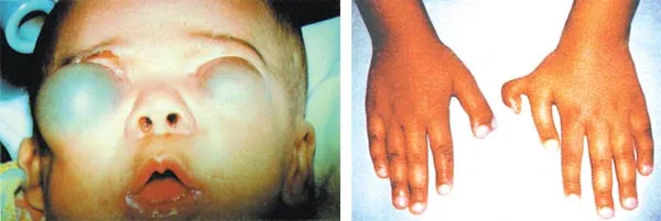 These photographs show some of the damaging effects of mutation on the human body. A process that cripples individuals or leaves them ill cannot, of course, giv